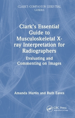 Clark’s Essential Guide to Musculoskeletal X-ray Interpretation for Radiographers - Amanda Martin