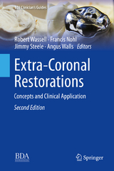 Extra-Coronal Restorations - 