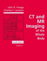 CT and MR Imaging of the Whole Body - Haaga, John R.; Lanzieri, Charles F.; Gilkeson, Robert C.