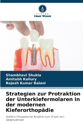 Strategien zur Protraktion der Unterkiefermolaren in der modernen Kieferorthopädie - Shambhavi Shukla, Amitabh Kallury, Rajesh Kumar Balani