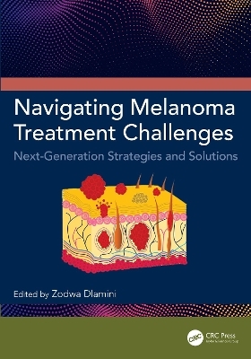 Navigating Melanoma Treatment Challenges - 