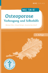 Osteoporose - Michael Elies, Eckard Krüger, Annette Kerckhoff