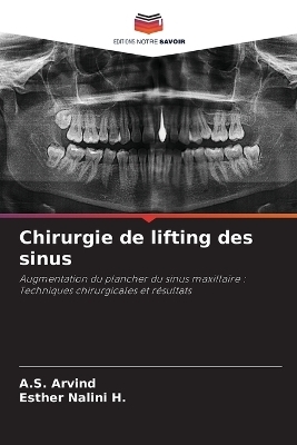 Chirurgie de lifting des sinus - A. S. Arvind, Esther Nalini H.