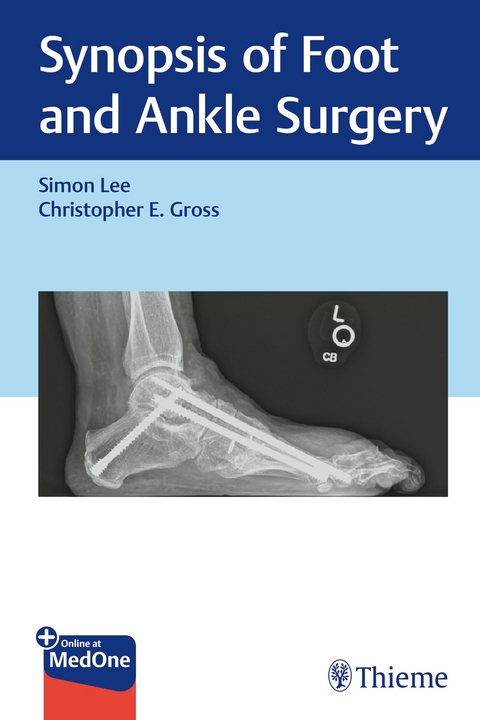 Synopsis of Foot and Ankle Surgery - Simon Lee, Christopher Gross