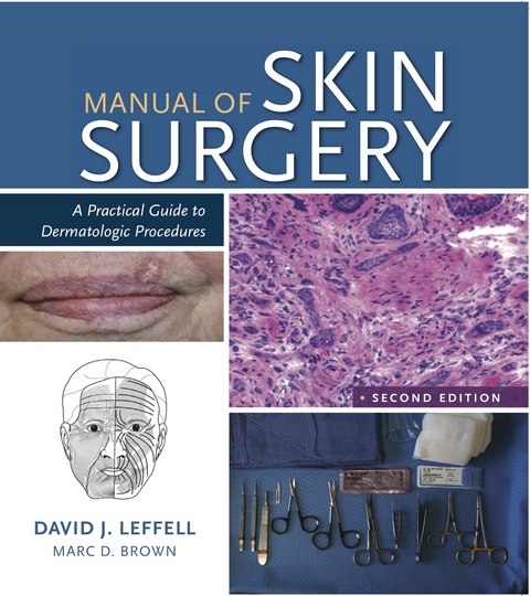 Manual of Skin Surgery - David J. Leffell, Marc D. Brown