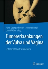 Tumorerkrankungen der Vulva und Vagina - 