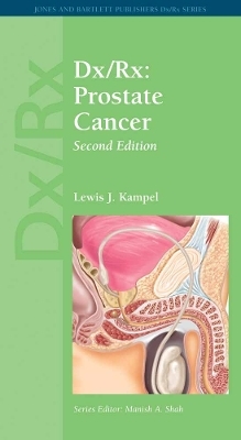 Dx/Rx: Prostate Cancer - Lewis J. Kampel