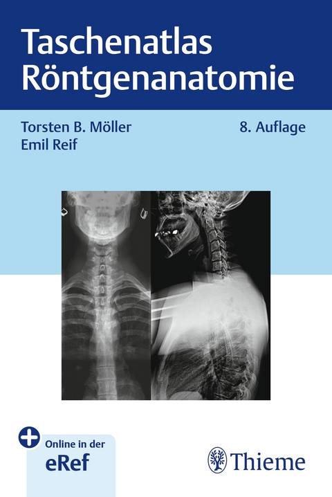 Taschenatlas Röntgenanatomie - Torsten Bert Möller, Emil Reif