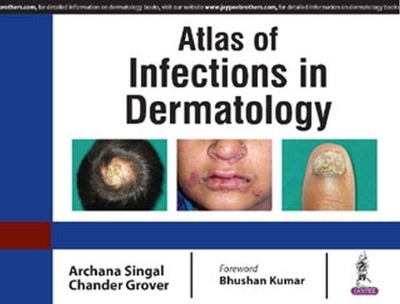 Atlas of Infections in Dermatology - Archana Singal, Chander Grover