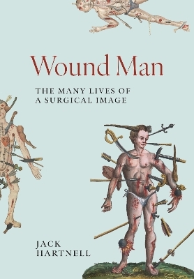 Wound Man - Jack Hartnell