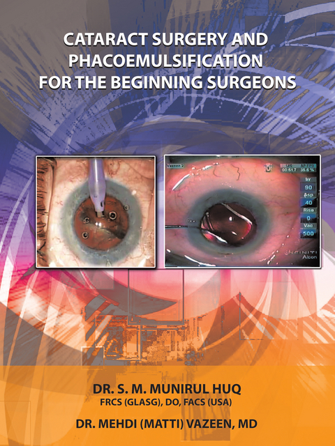 Cataract Surgery and Phacoemulsification for the Beginning   Surgeons - Dr.Mehdi Vazeen MD, Dr.S.M.Munirul Huq