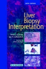 Liver Biopsy Interpretation - Scheuer, Peter J.; Lefkowitch, Jay H.