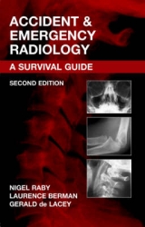 Accident and Emergency Radiology - Raby, Nigel; Berman, Laurence; De Lacey, Gerald