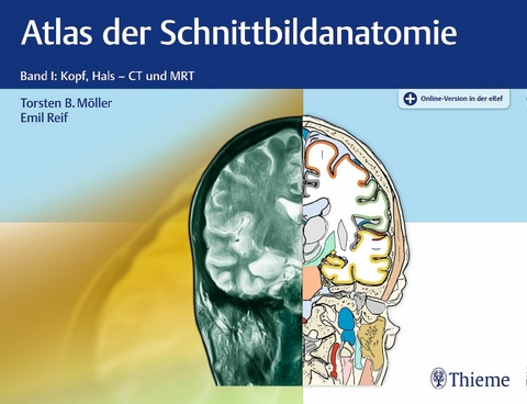 Atlas der Schnittbildanatomie -  Torsten Bert Möller,  Emil Reif