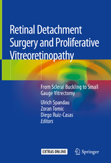 Retinal Detachment Surgery and Proliferative Vitreoretinopathy - 
