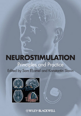 Neurostimulation - 