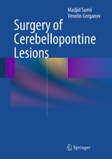 Surgery of Cerebellopontine Lesions - Madjid Samii, Venelin Gerganov
