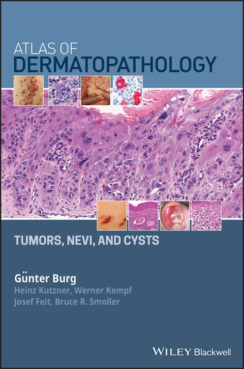 Atlas of Dermatopathology -  G nter Burg,  Josef Feit,  Werner Kempf,  Heinz Kutzner,  Bruce R. Smoller