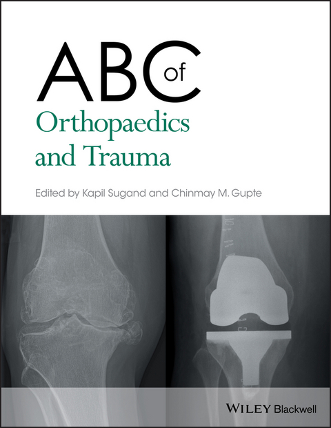 ABC of Orthopaedics and Trauma - 