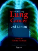 Textbook of Lung Cancer - Hansen, Heine