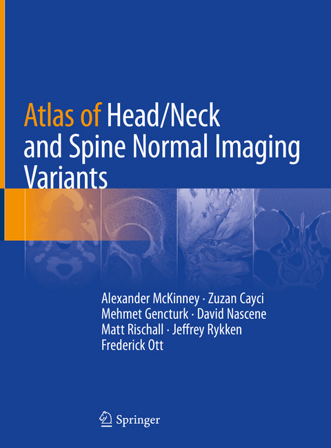 Atlas of Head/Neck and Spine Normal Imaging Variants -  Alexander McKinney,  Zuzan Cayci,  Mehmet Gencturk,  David Nascene,  Matt Rischall,  Jeffrey Rykken,  Fred