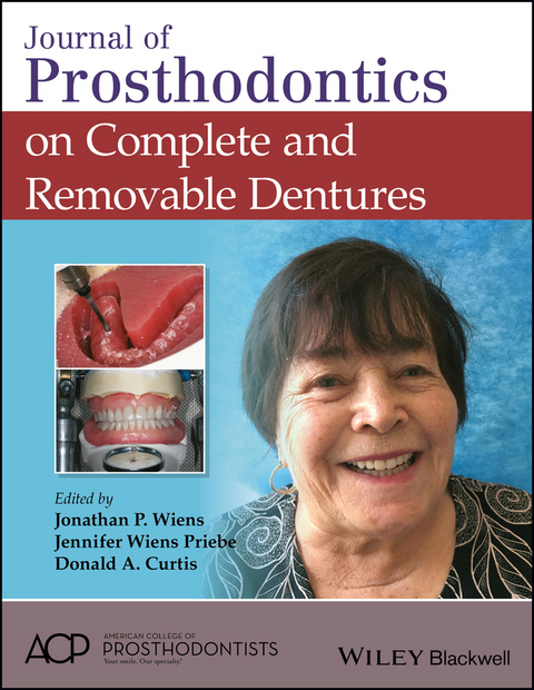 Journal of Prosthodontics on Complete and Removable Dentures - 