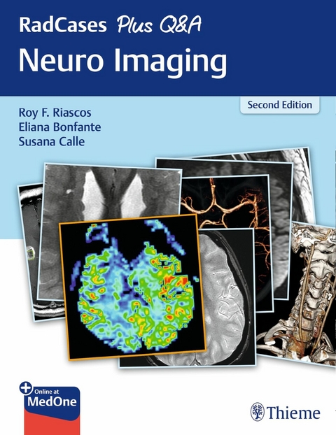RadCases Plus Q&A Neuro Imaging - 