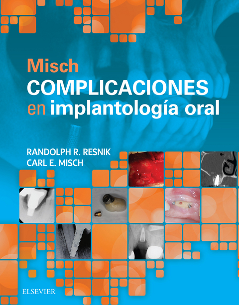 Misch. Complicaciones en implantología oral -  Randolph Resnik,  Carl E. Misch