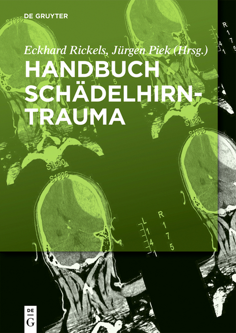 Handbuch Schädelhirntrauma - 