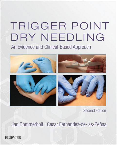Trigger Point Dry Needling E-Book - 