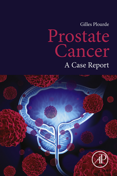 Prostate Cancer -  Gilles Plourde