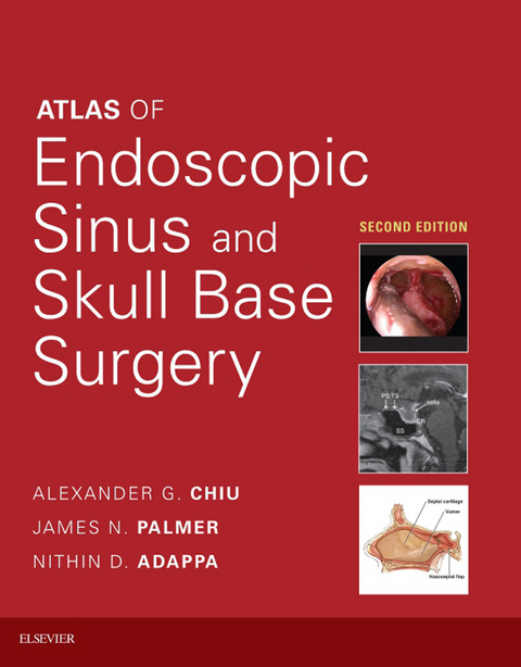 Atlas of Endoscopic Sinus and Skull Base Surgery E-Book -  Alexander G. Chiu,  James N. Palmer,  Nithin D Adappa