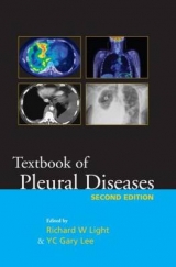 Textbook of Pleural Diseases Second Edition - Light, Richard W.; Lee, Y C Gary