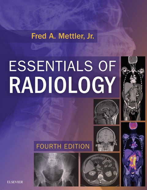 Essentials of Radiology -  Fred A. Mettler