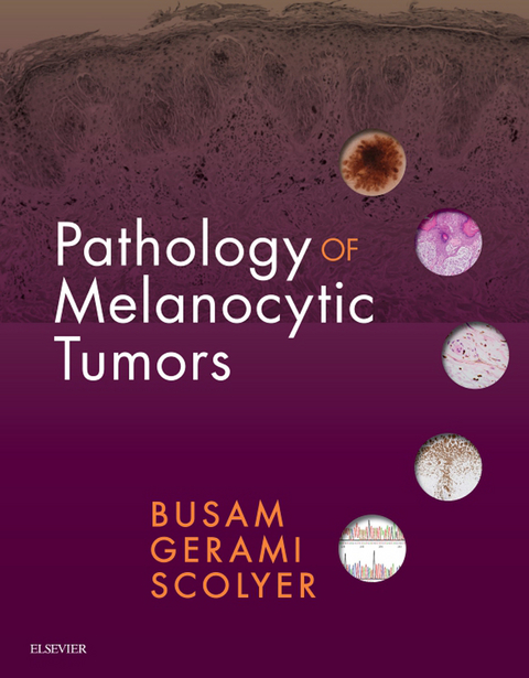 Pathology of Melanocytic Tumors -  Klaus J. Busam,  Pedram Gerami,  Richard A Scolyer