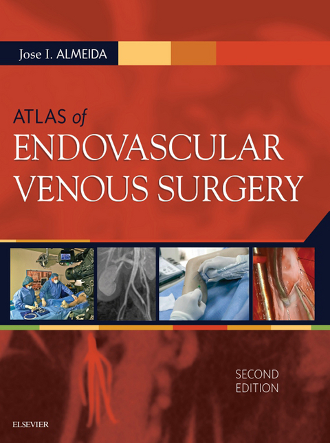 Atlas of Endovascular Venous Surgery -  Jose Almeida