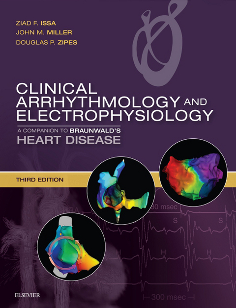Clinical Arrhythmology and Electrophysiology E-Book -  Ziad Issa,  John M. Miller,  Douglas P. Zipes