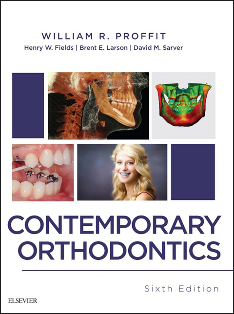 Contemporary Orthodontics -  Henry Fields,  Brent Larson,  William R. Proffit,  David M. Sarver