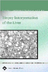 Biopsy Interpretation of the Liver - Geller, Stephen A.; Petrovic