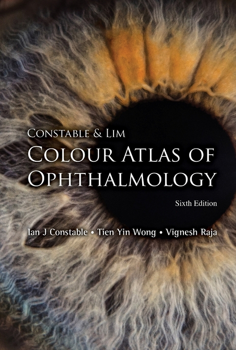 CONSTAB & LIM COLO ATLAS (6TH ED) - Ian J Constable, Tien Yin Wong, Vignesh Raja