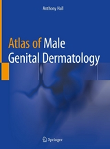 Atlas of Male Genital Dermatology -  Anthony Hall