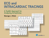 ECG and Intracardiac Tracings -  George J. Klein