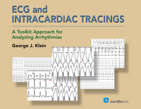 ECG and Intracardiac Tracings -  George J. Klein