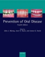 Prevention of Oral Disease - J Murray CBE, John; H Nunn, June; G Steele, James