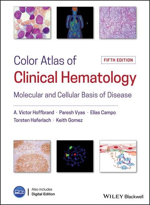 Color Atlas of Clinical Hematology -  Elias Campo,  Keith Gomez,  Torsten Haferlach,  Victor Hoffbrand,  Paresh Vyas
