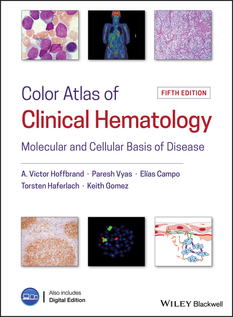 Color Atlas of Clinical Hematology -  Elias Campo,  Keith Gomez,  Torsten Haferlach,  A. Victor Hoffbrand,  Paresh Vyas