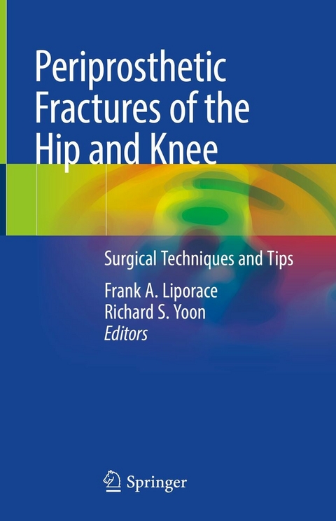 Periprosthetic Fractures of the Hip and Knee - 