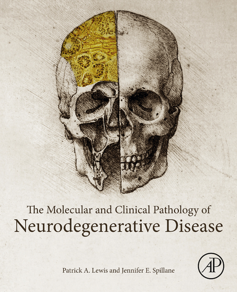 Molecular and Clinical Pathology of Neurodegenerative Disease -  Patrick A. Lewis,  Jennifer E. Spillane