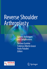 Reverse Shoulder Arthroplasty - 