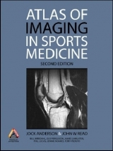 Atlas of Imaging in Sports Medicine - Anderson, Jock; Read, John